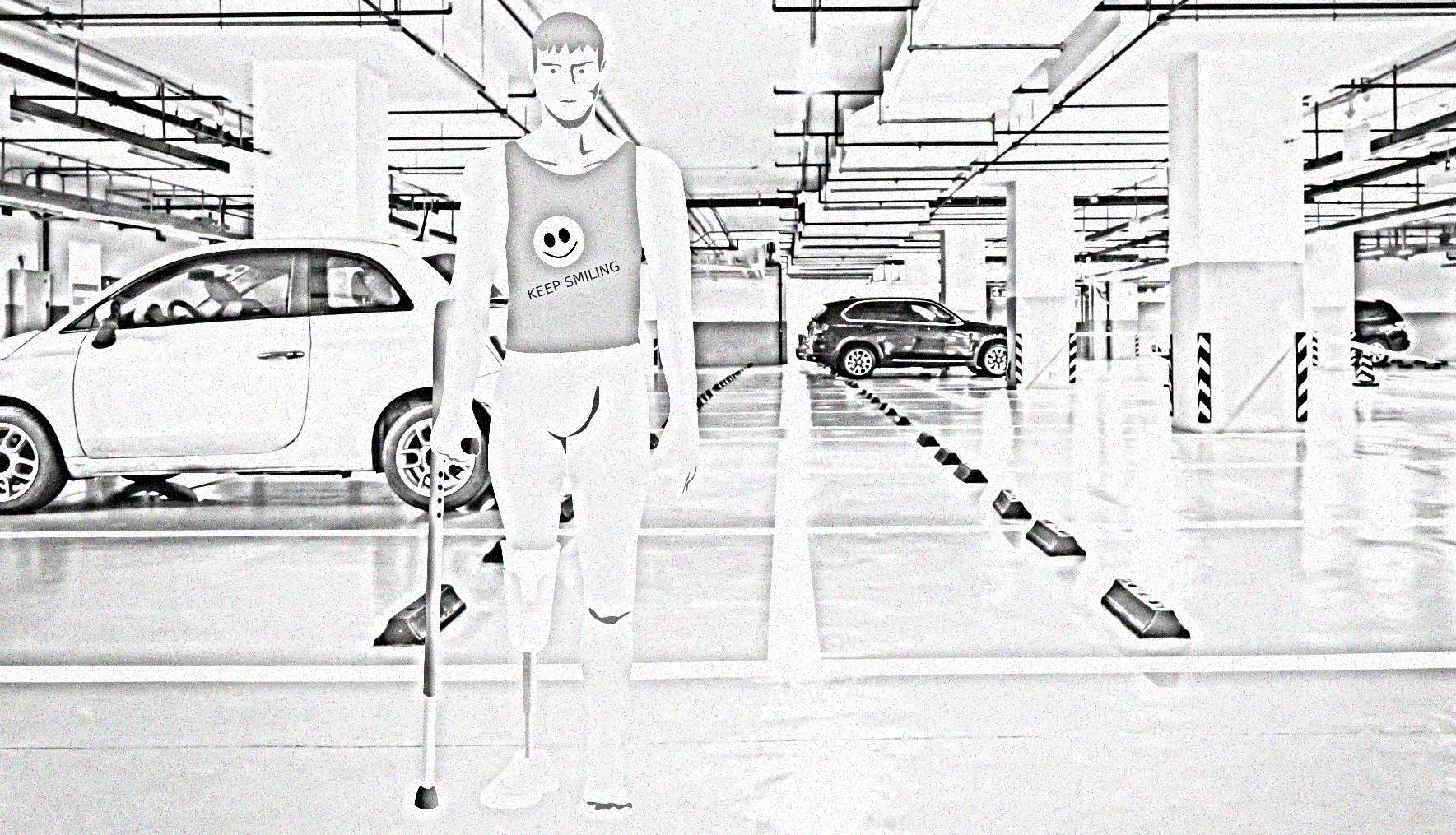 Can you drive if you have had a limb amputated